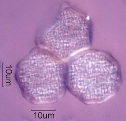 Elm (Ulmus sp.) Pollen Under the Microscope