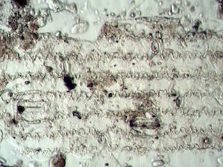 Stomata Under the Microscope