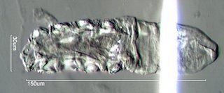 Demodex brevis