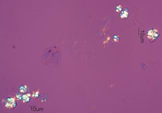 Organic Precipitates