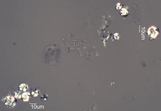 Organic Precipitates