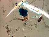 Mite Leg