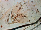 Dust Mite