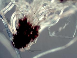 Cotton Fabric Contaminants