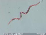 Slime Mold Capillitium