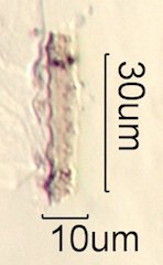 Phytolith