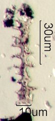 Phytolith