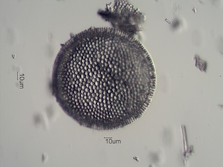 Diatomaceous Earth, Celite 535