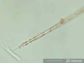 Leptothrix