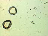 Cesium Alum Test for Aluminum