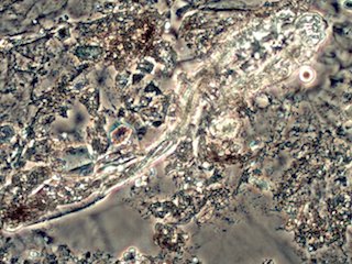 Demodex folliculorum