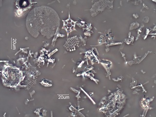 Diatomaceous Earth, Celite 535