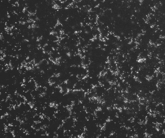 Percent Obscuration