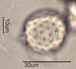 Periporate Pollen