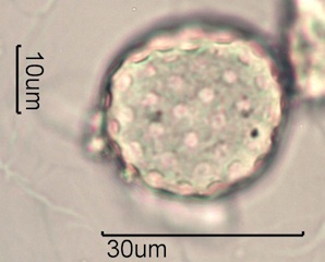 Periporate Pollen
