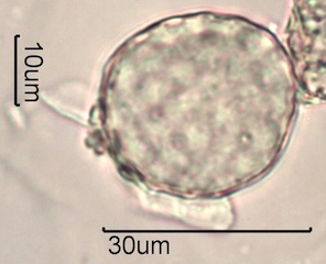 Periporate Pollen