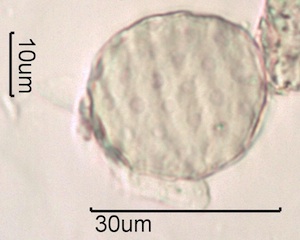 Periporate Pollen