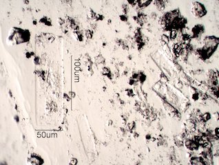 Urea