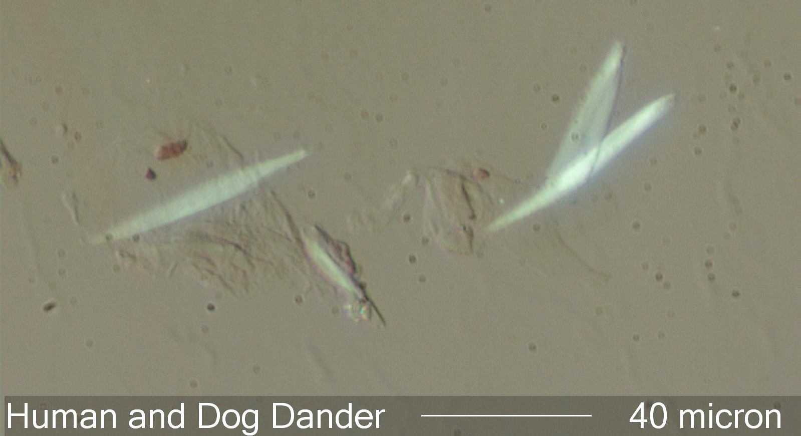 Dog Dander