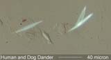 Human and Dog Dander