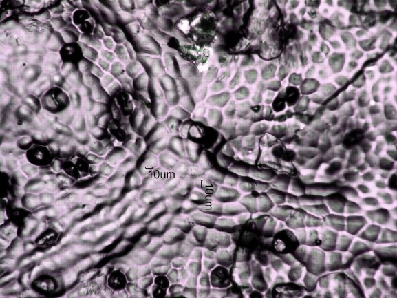 Stomata Under The Microscope