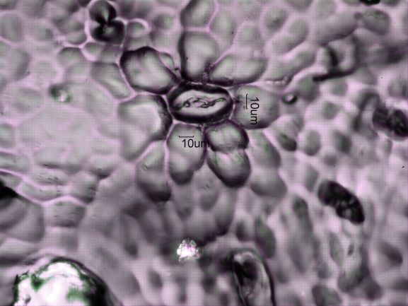 Stomata Under The Microscope