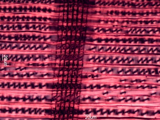 Abies balsamea, Radial-Section