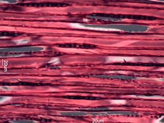 Abies balsamea, Tangential-Section