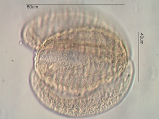Alpine Fir Pollen