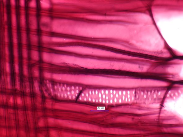 Acer negundo, Radial Section