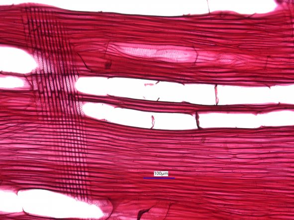 Acer negundo, Radial Section