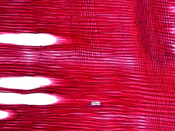 Acer negundo, Radial Section