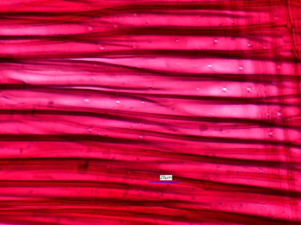 Acer negundo, Radial Section