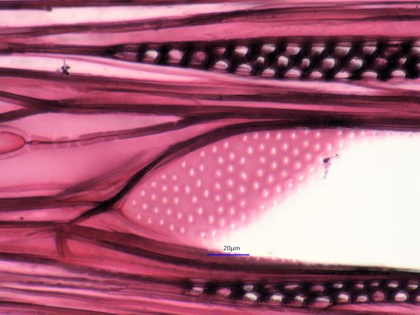 Acer negundo, Tangential Section