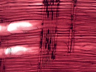Acer saccharum, Radial-Section