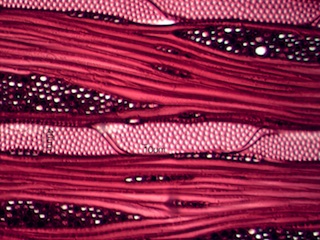 Acer saccharum, Tangential-Section