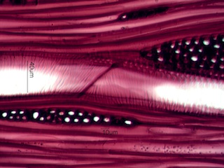 Acer saccharum, Tangential-Section