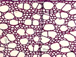 Aesculus glabra, Cross-Section