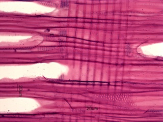 Aesculus glabra, Radial-Section
