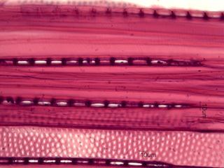 Aesculus glabra, Tangential-Section