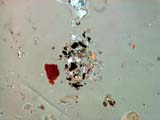 Wet Road Agglomerate
