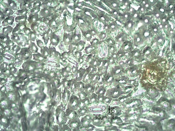 Stomata Under The Microscope