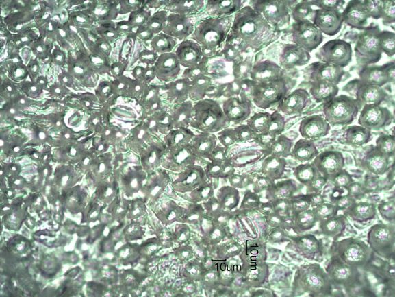 Stomata Under The Microscope