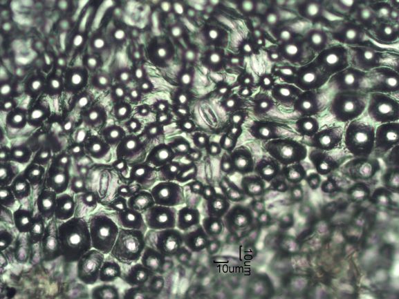 Stomata Under The Microscope