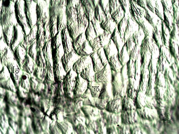 Stomata Under The Microscope