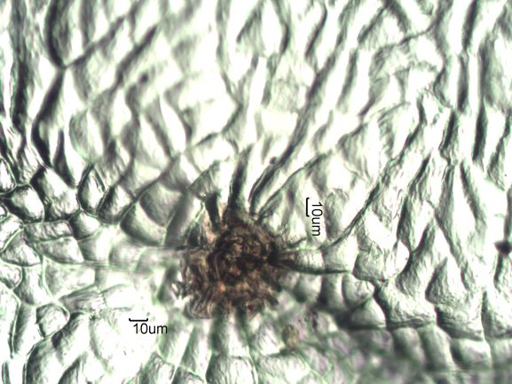 Stomata Under The Microscope