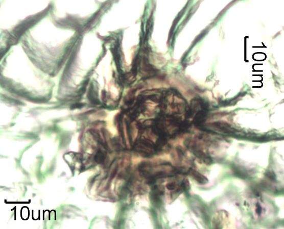 Stomata Under The Microscope