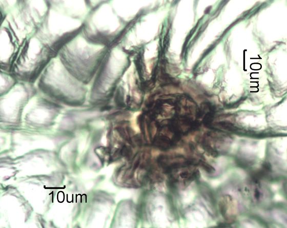 Stomata Under The Microscope