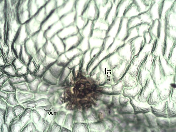 Stomata Under The Microscope