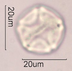 Alder Pollen under the Microscope